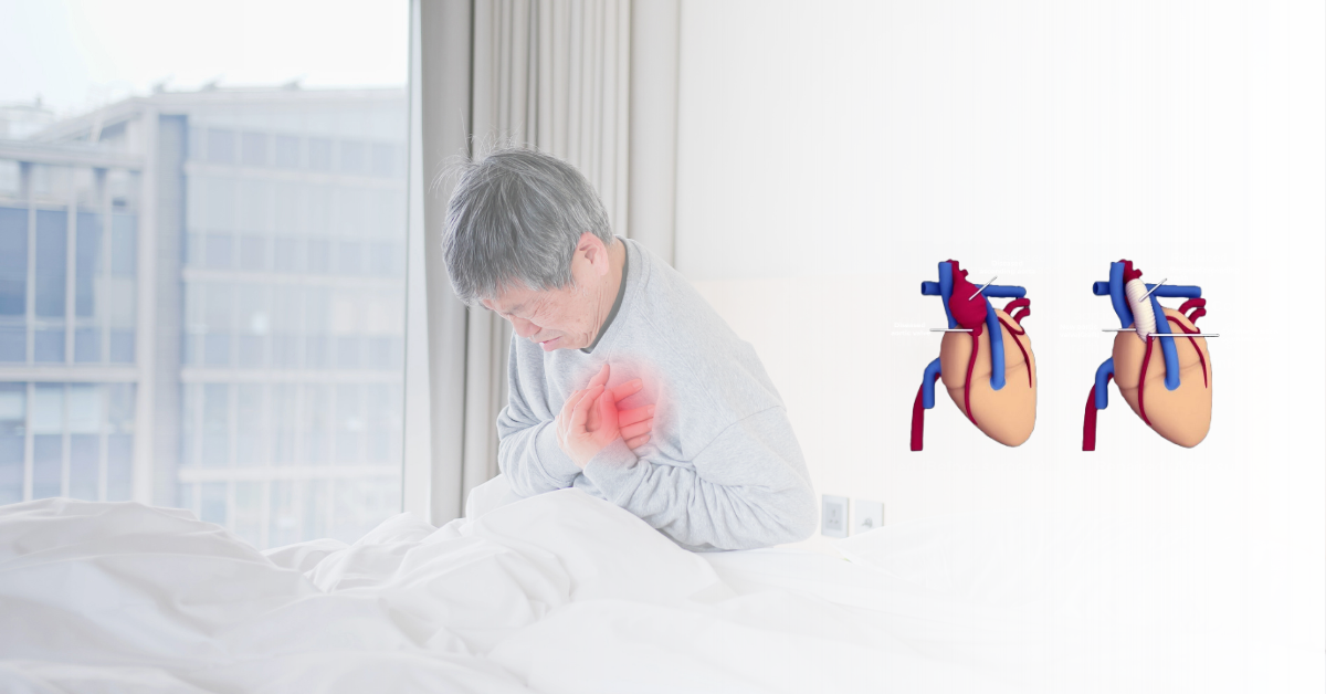 Surgical Techniques Used in Bentall Procedure